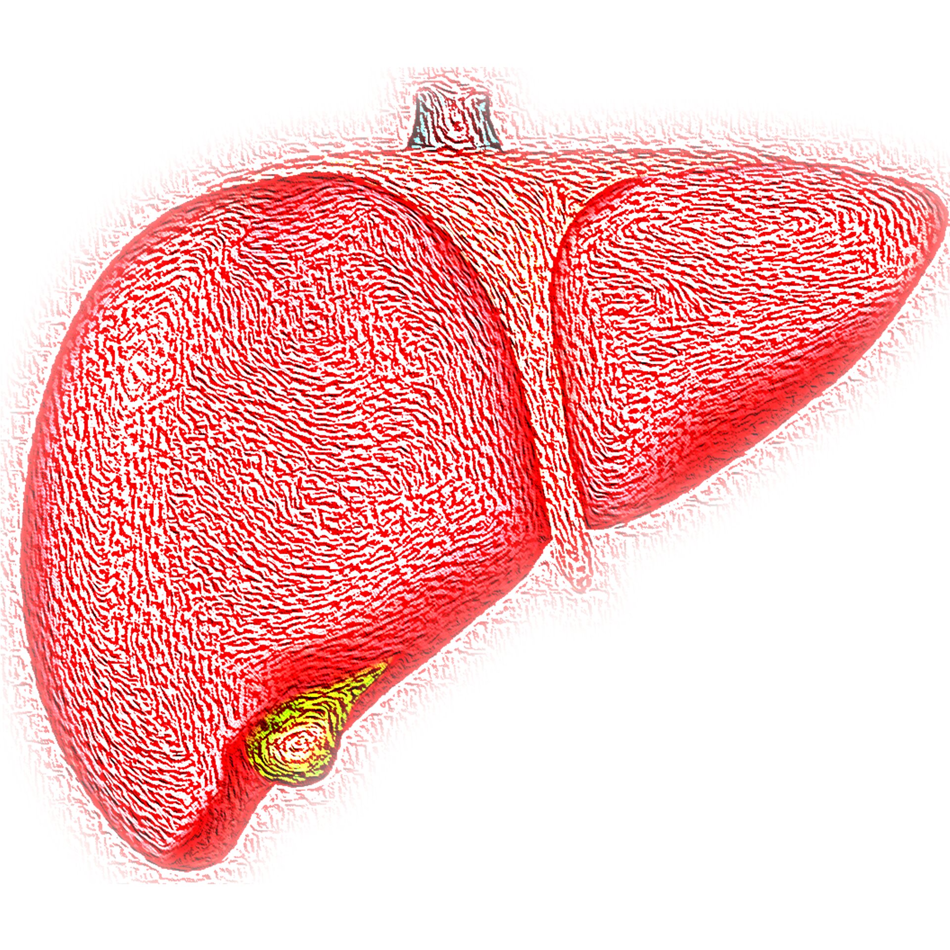 Study of cancer-induced liver inflammation finds a promising therapeutic target