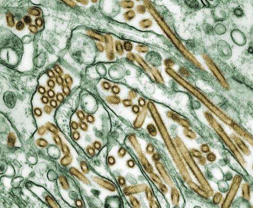 First severe bird flu case in US sparks alarm