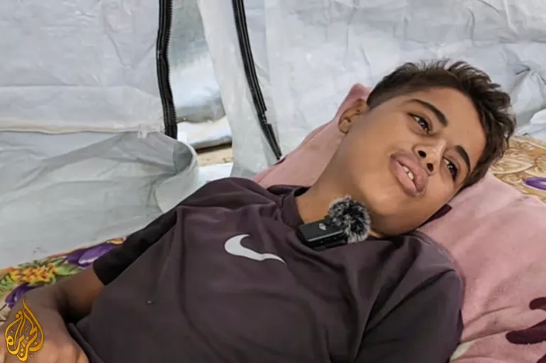The ever-present wounds of Gaza’s children from Israel’s war