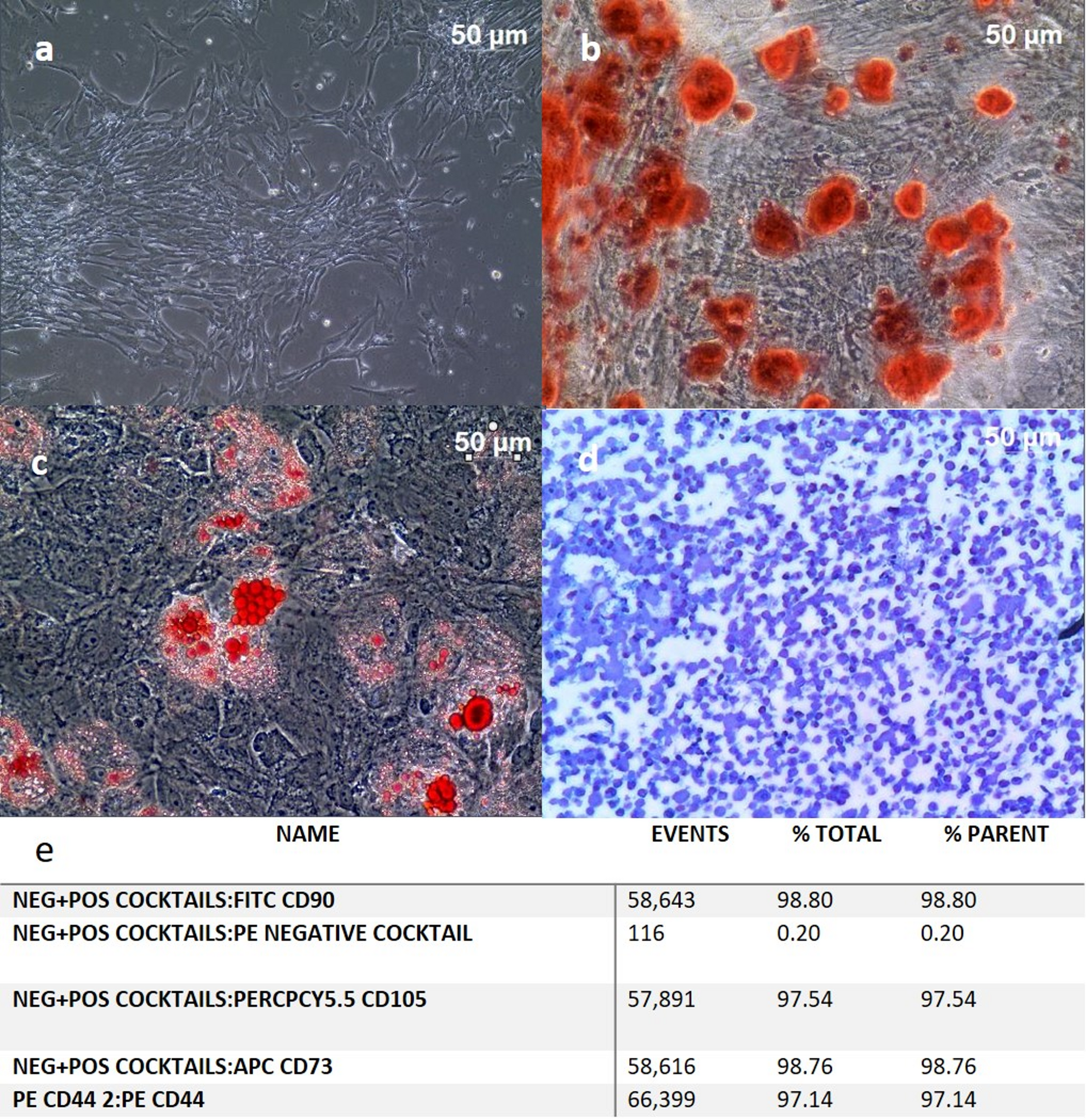 Human umbilical cord mesenchymal stromal cells derivatives in treating diabetic foot ulcers: a phase I/II safety and efficacy trial | Stem Cell Research & Therapy