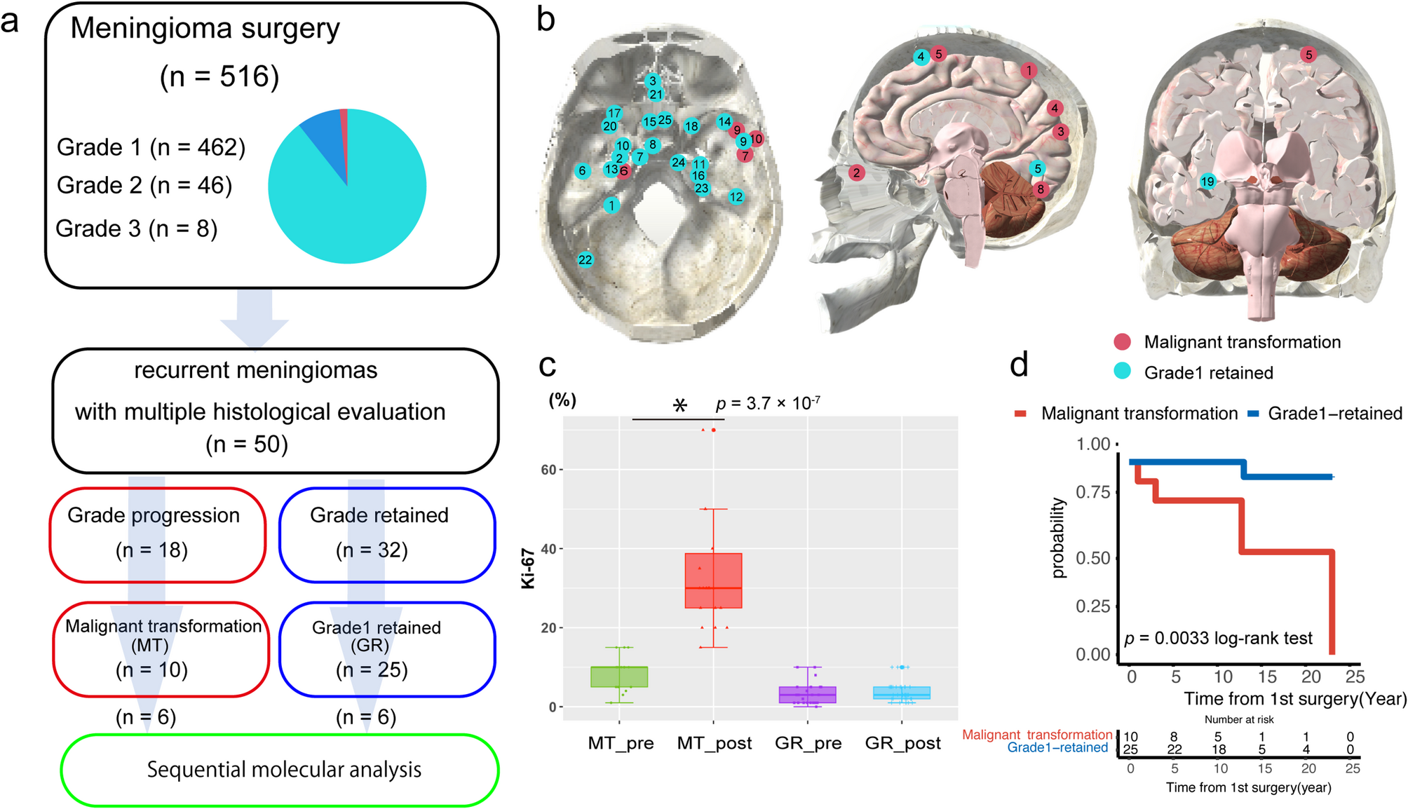 Sequential omics analysis reveals molecular signatures of malignant transformation in recurrent meningiomas | Acta Neuropathologica Communications