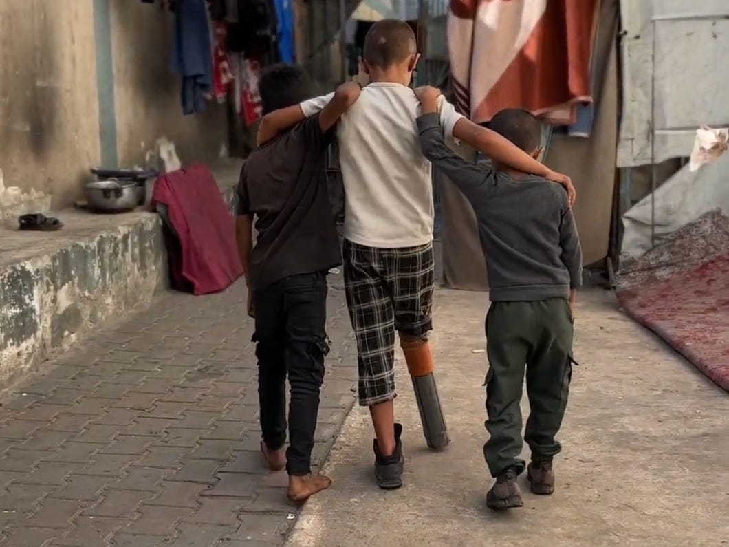 Israel Forces Child Amputees in Gaza to Use Makeshift Prosthetics Israel Forces Child Amputees in Gaza to Use Makeshift Prosthetics