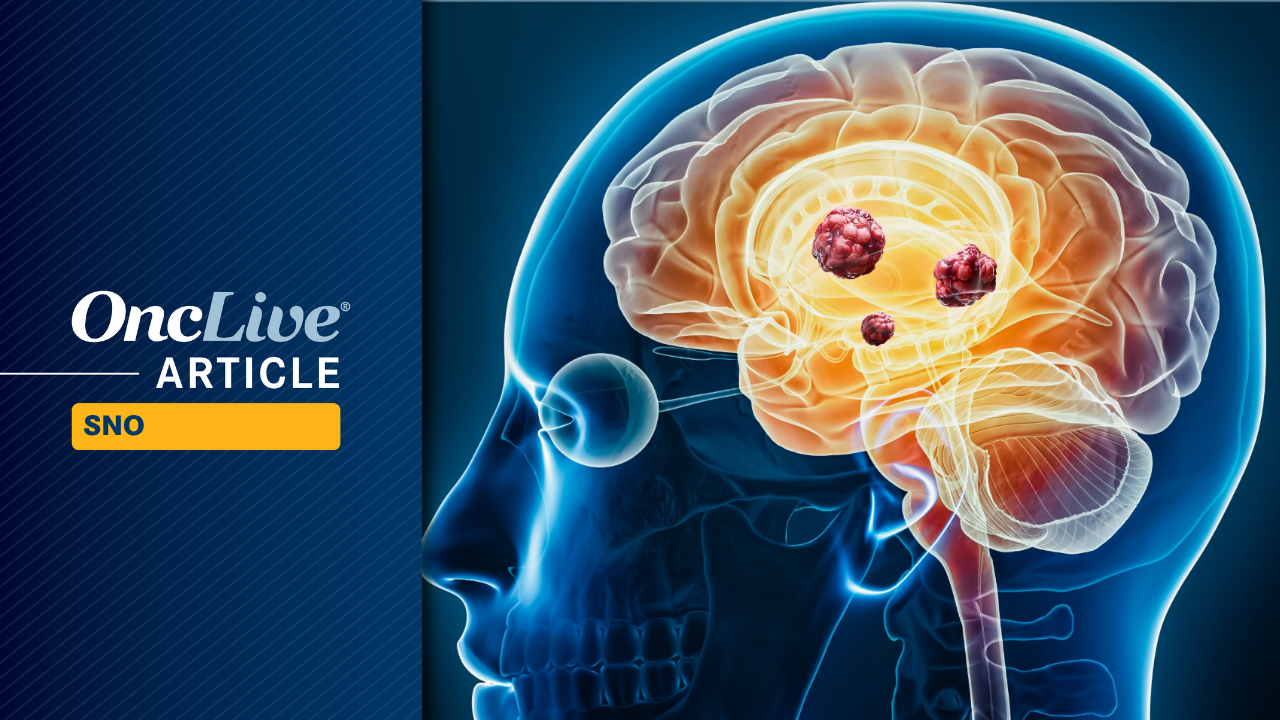 Mirdametinib Shows Improved ORR Over Time in NF1-Associated Symptomatic Plexiform Neurofibroma Mirdametinib Shows Improved ORR Over Time in NF1-Associated Symptomatic Plexiform Neurofibroma