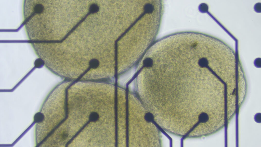 Brain organoid scientists worried by push into biocomputing Brain organoid scientists worried by push into biocomputing