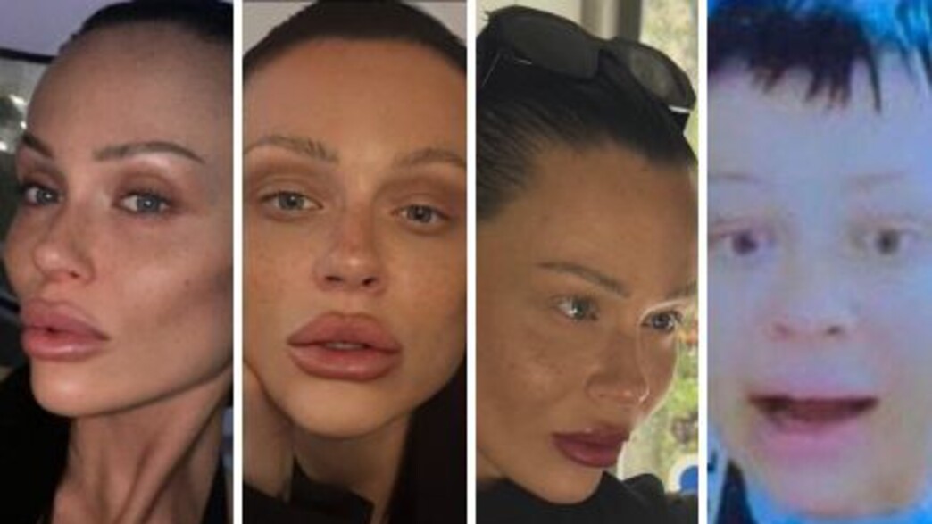 מהתלונה נגד שי אביטל ועד המעצר בחשד לרצח: “לין פאר נפלה לסמים” מהתלונה נגד שי אביטל ועד המעצר בחשד לרצח: “לין פאר נפלה לסמים”