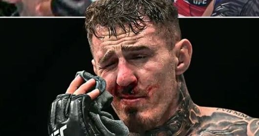 UFC Strengthens Eye Gouging Crackdown After Aspinall Incident – 조선일보