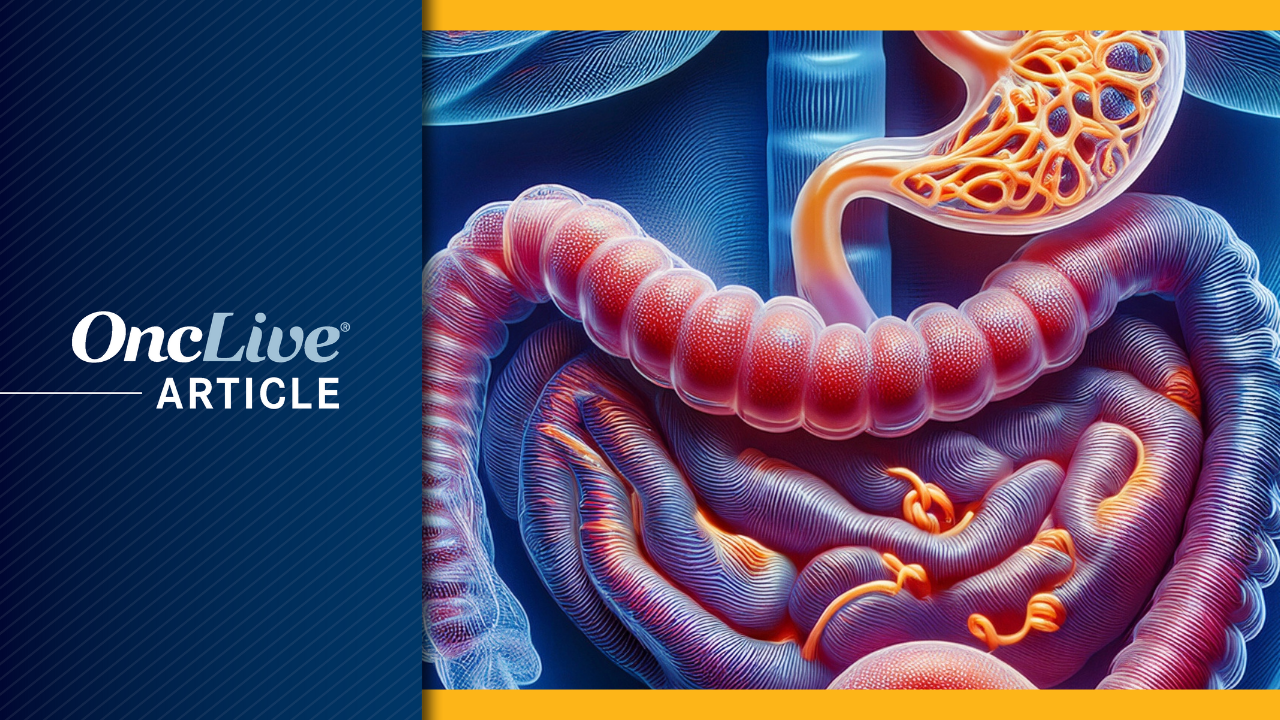 Bezuclastinib Plus Sunitinib Shows PFS Benefit in Second-Line GIST Bezuclastinib Plus Sunitinib Shows PFS Benefit in Second-Line GIST