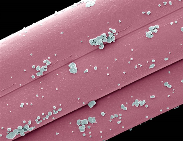 Breakthrough in bone regeneration using nanoparticle-stem cell hybrid Breakthrough in bone regeneration using nanoparticle-stem cell hybrid