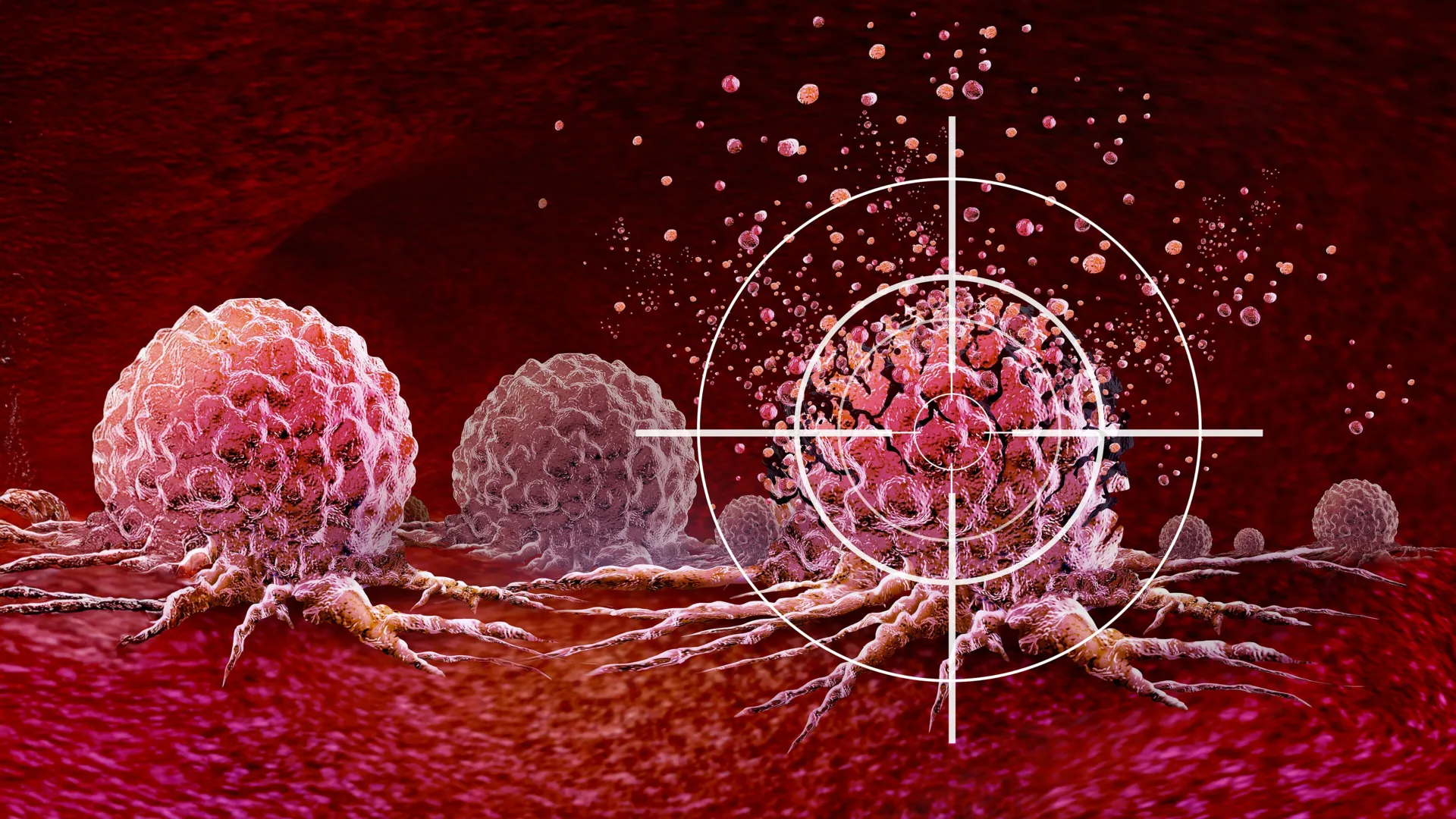 Smart drug strikes a hidden RNA weak point in cancer cells