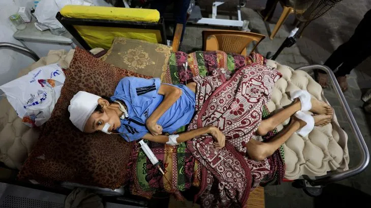 Hiding the true numbers it has killed in Gaza