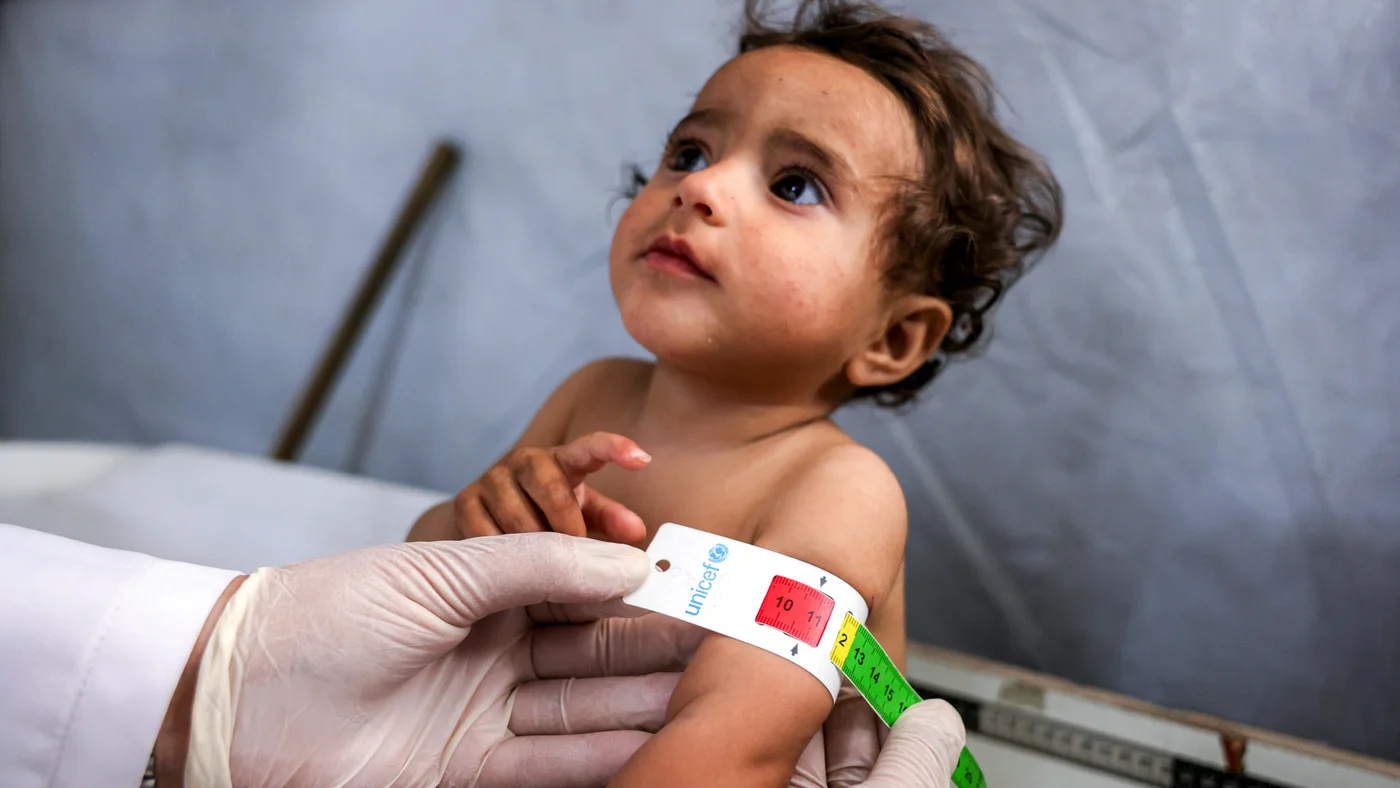 Rising maternal malnutrition in Gaza drives up newborn mortality Rising maternal malnutrition in Gaza drives up newborn mortality