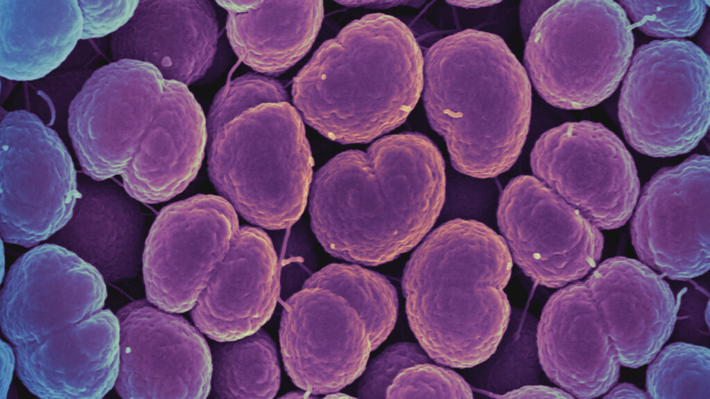 Lancet study shows new antibiotic effective against gonorrhea