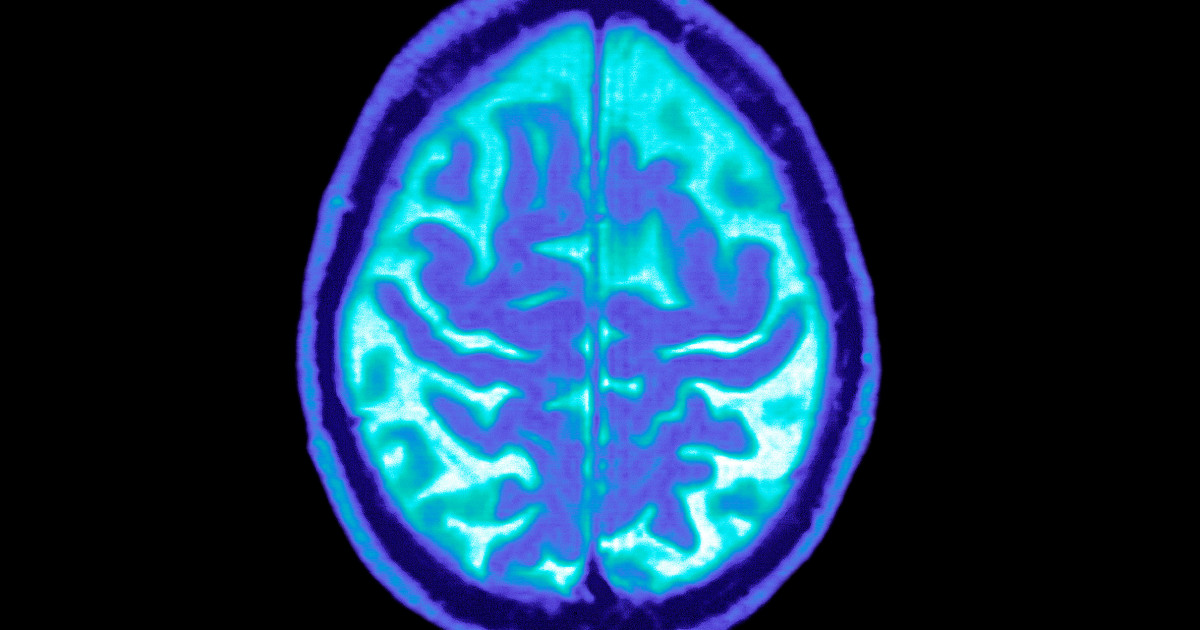 Novo Nordisk still sees potential in Ozempic for Alzheimer’s, despite trial setbacks Novo Nordisk still sees potential in Ozempic for Alzheimer’s, despite trial setbacks