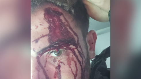 ‘They heard Hebrew and hit me in the head with an