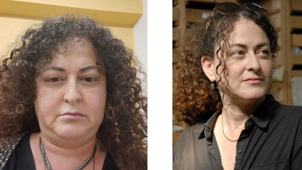 הרופאים פספסו גידול במשך 20 שנה