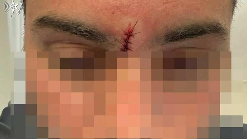 קרב הגרסאות סביב אירוע הגרזן קרב הגרסאות סביב אירוע הגרזן