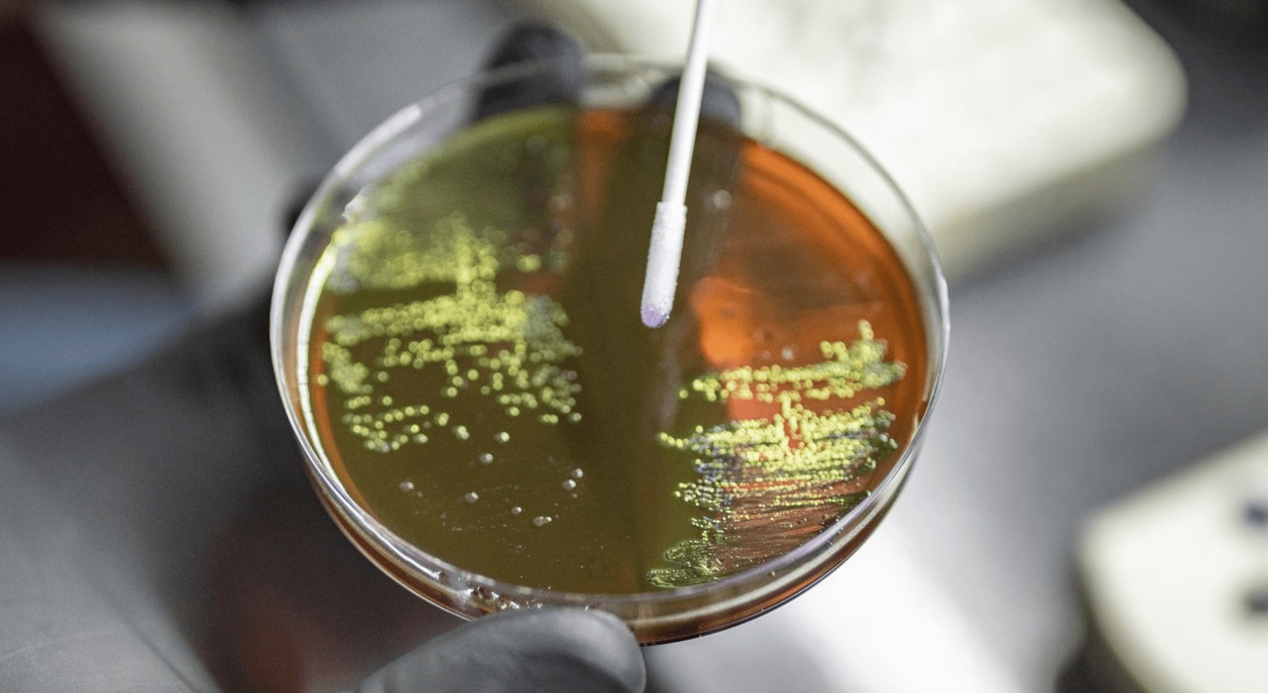 Infection Prevention And Control Falters Post-Pandemic – Increasing AMR Risks 