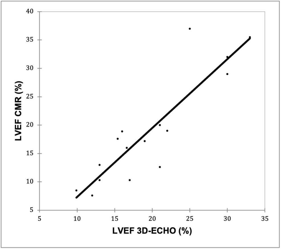 Correlation of 3D Echocardiography With Cardiac MRI in Patients With Acute Left Ventricular Dysfunction in the Age Group of One Month to 18 Years