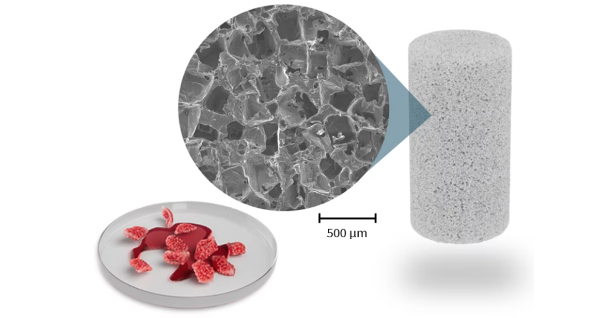 Bone Regeneration Technology Used in First Patient Surgery | News Bone Regeneration Technology Used in First Patient Surgery | News