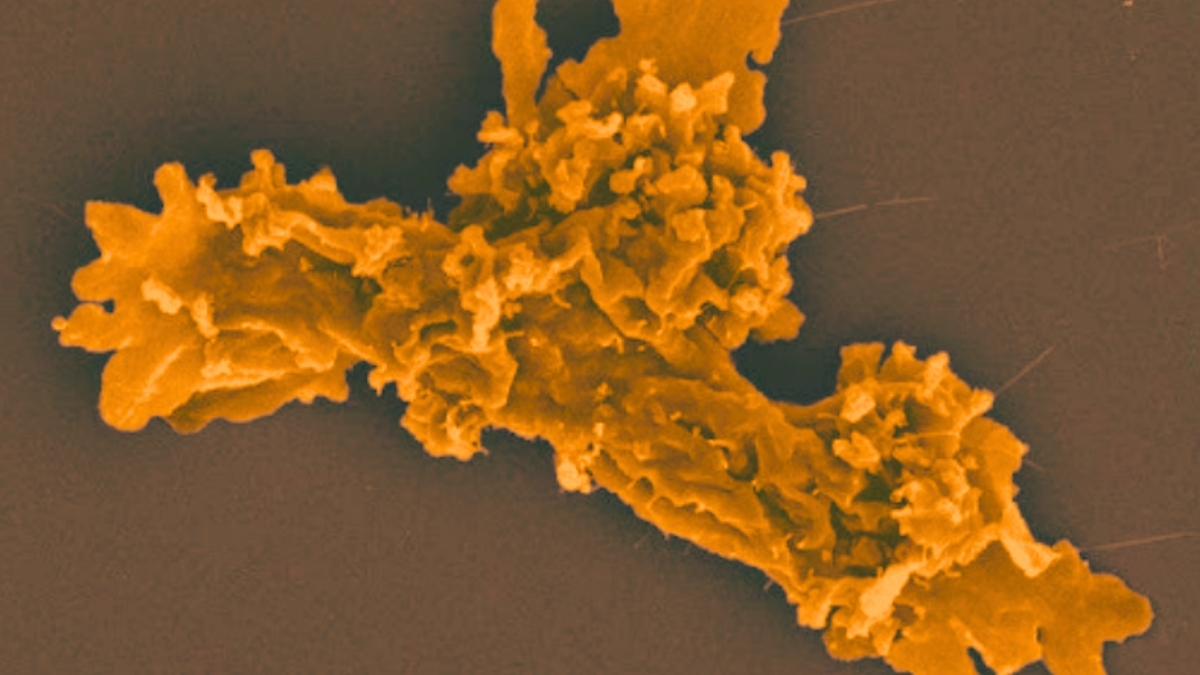 Extreme ‘Fire Amoeba’ Smashes Record For Heat Tolerance : ScienceAlert