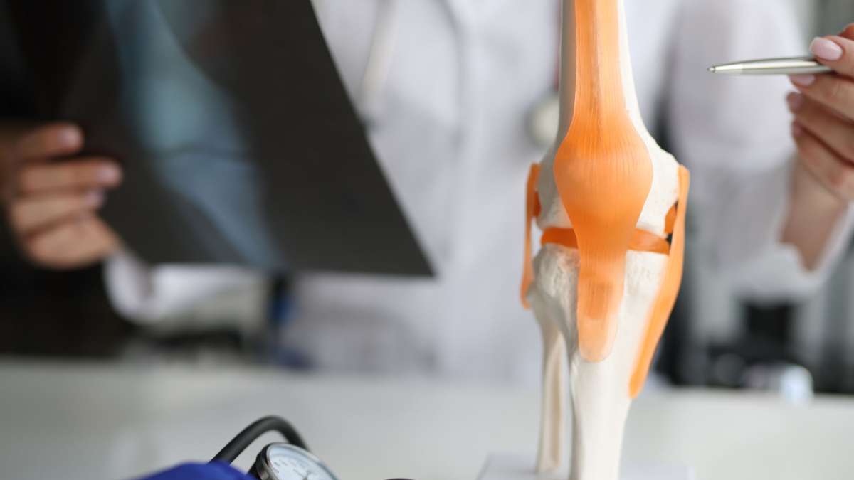 Challenge accepted: UCLA Health team works at warp speed to defeat osteoarthritis Challenge accepted: UCLA Health team works at warp speed to defeat osteoarthritis