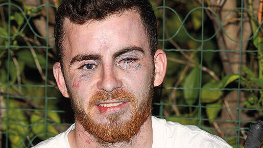 ‘The injury isn’t just our personal story, it’s the story of the entire nation’