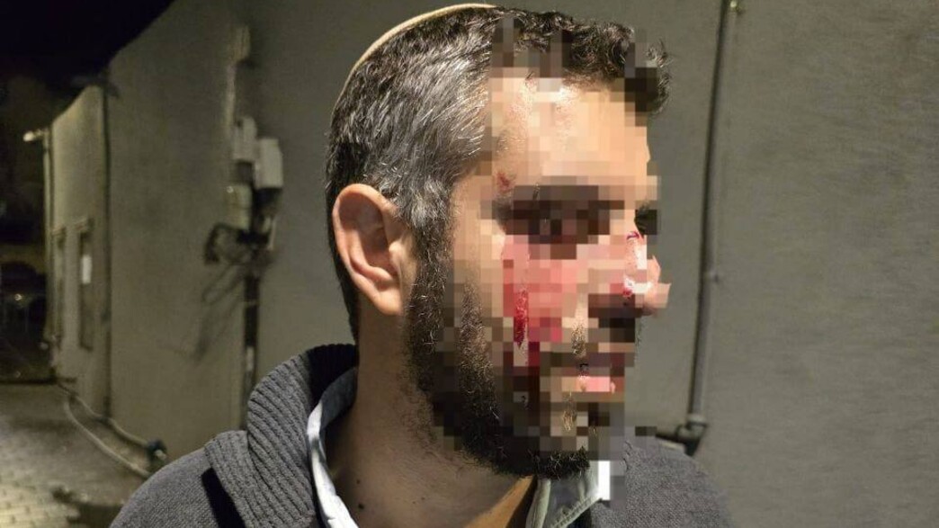 מורה בישיבה ביפו הותקף ופונה לבית החולים עם חבלות בפניו מורה בישיבה ביפו הותקף ופונה לבית החולים עם חבלות בפניו
