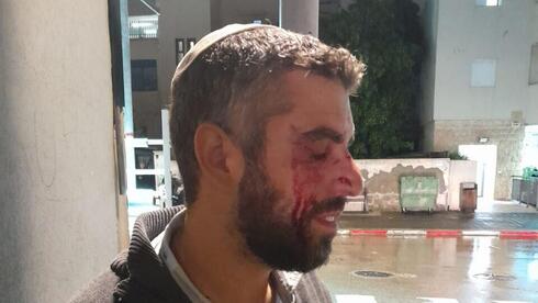 ‘a young man lunged at me shouting Allahu A