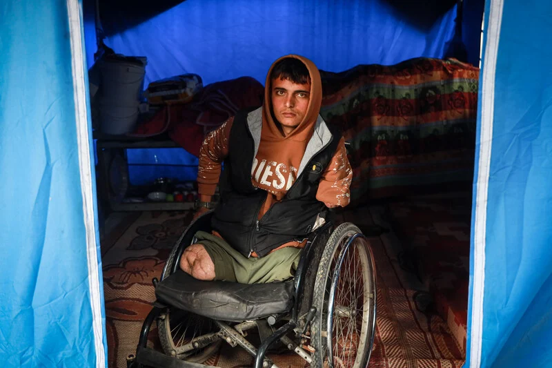 A genocide here, an amputation there