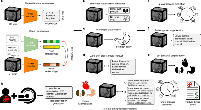 Merlin: a computed tomography vision–language foundation model and dataset Merlin: a computed tomography vision–language foundation model and dataset