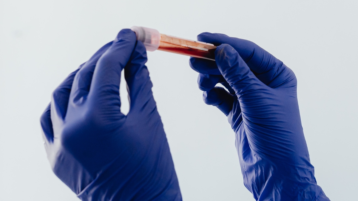 Women in Space Could Face a Hidden Blood-Clot Risk, Study Suggests : ScienceAlert