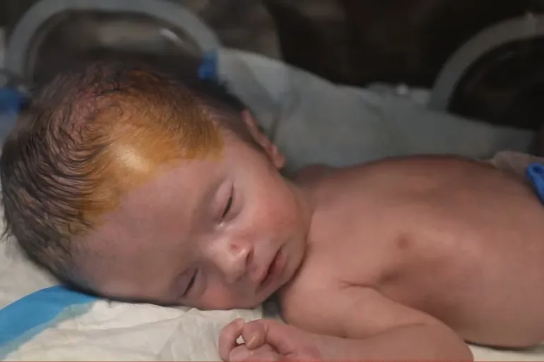 A surge in stillbirths & birth defects