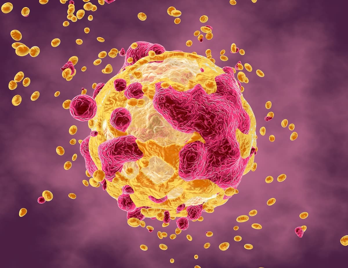 Closing the Trial Access Gap: Neuro-Symbolic AI and Oncology Trial Matching